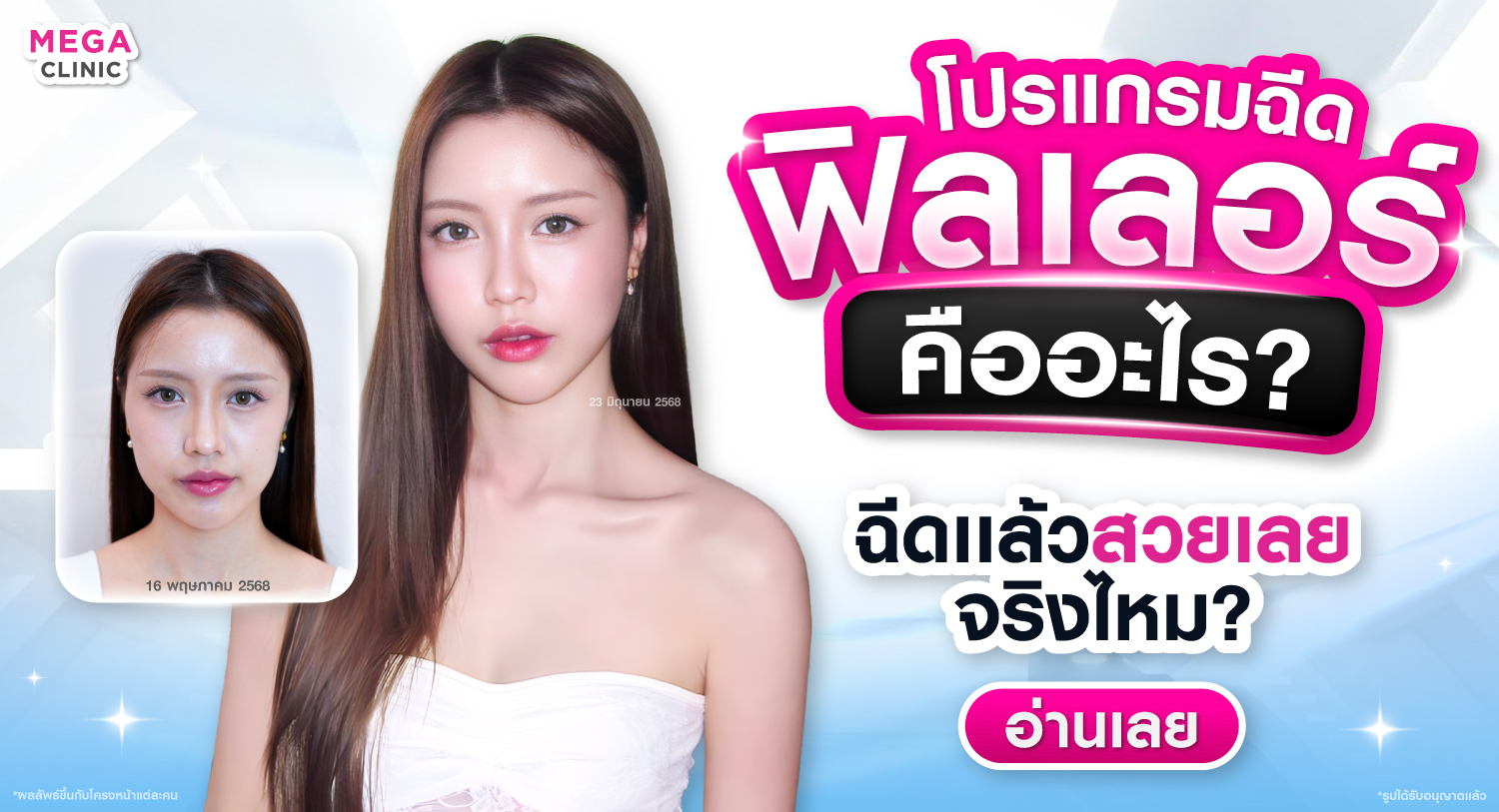 ฟิลเลอร์ คืออะไร