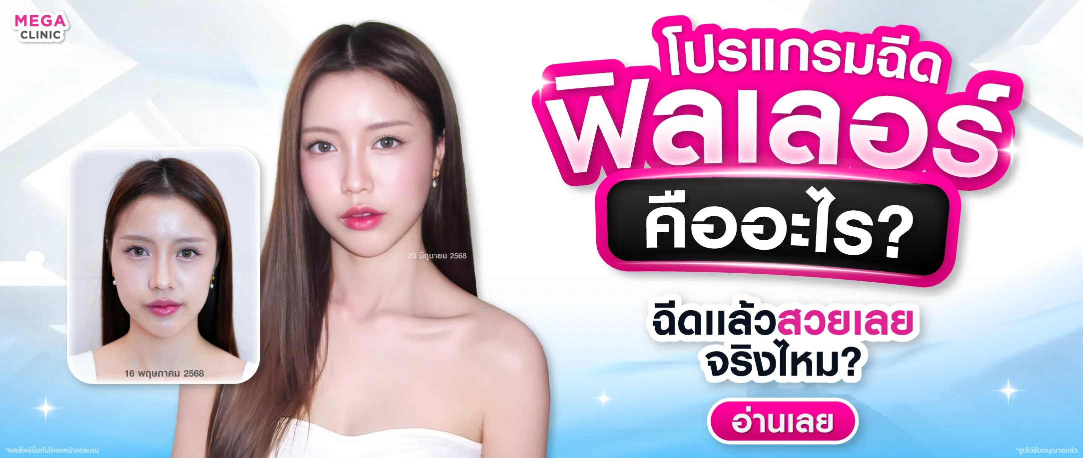 ฟิลเลอร์ คืออะไร