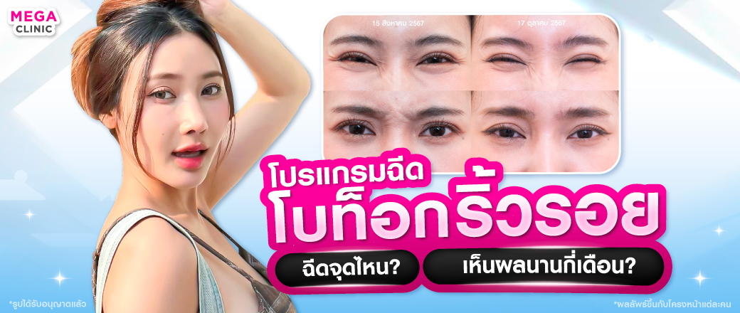 โบท็อก ริ้วรอย
