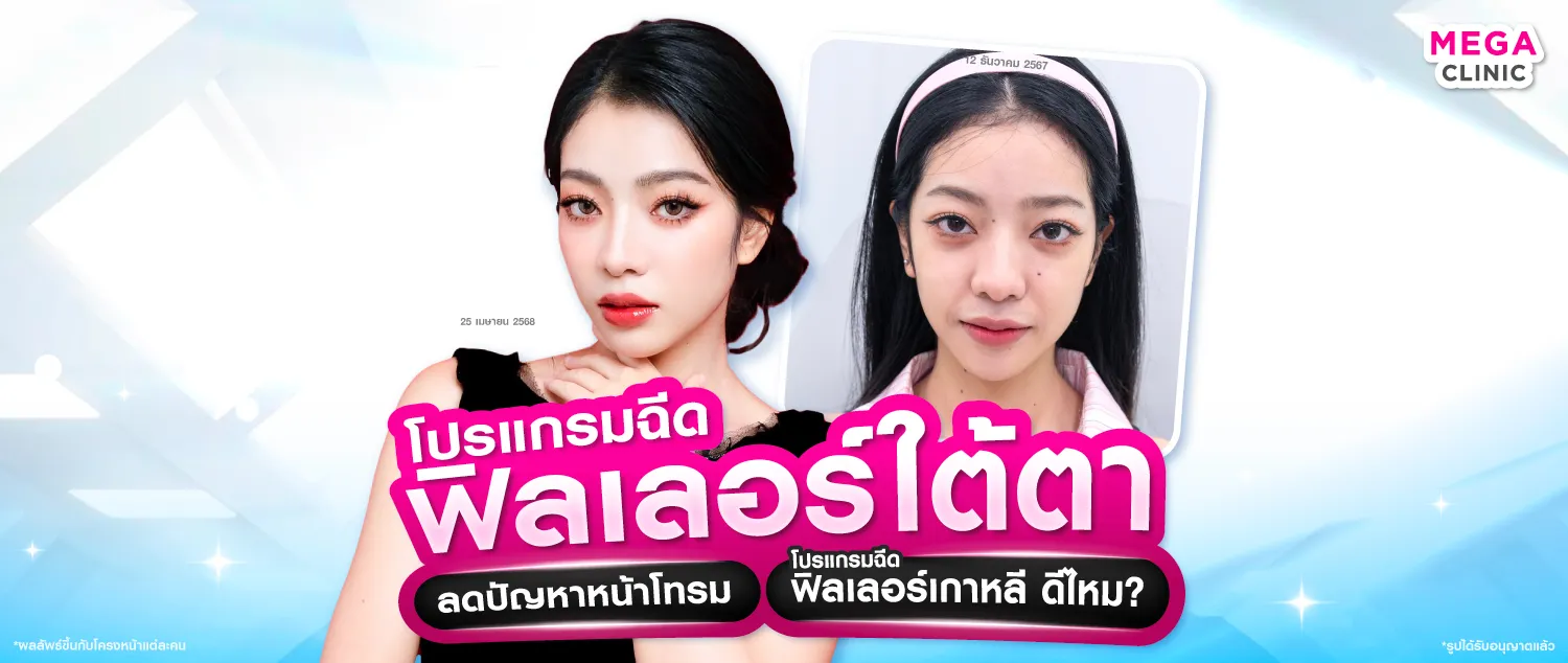 ฟิลเลอร์ใต้ตา ที่ไหนดี