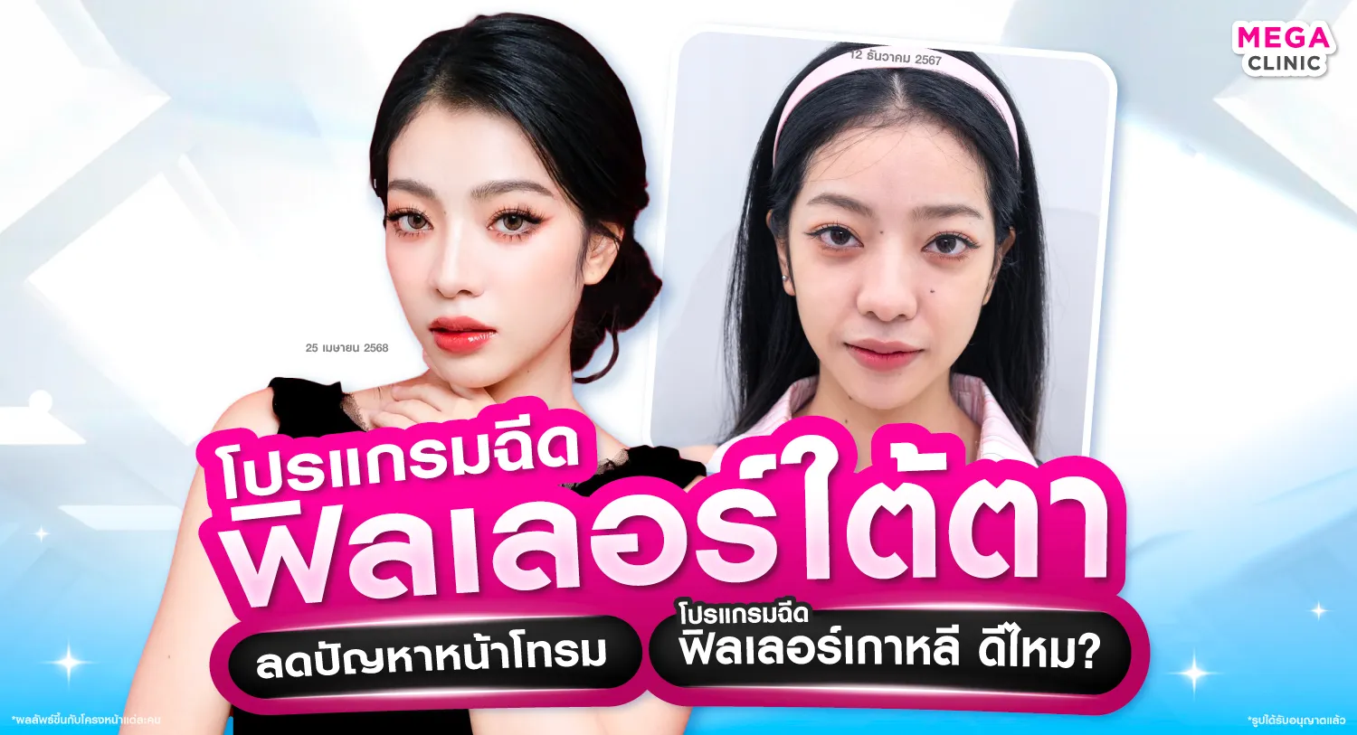 ฟิลเลอร์ใต้ตา ที่ไหนดี