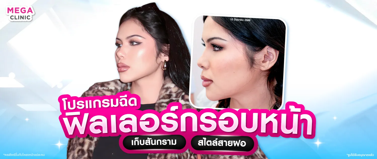 ฟิลเลอร์กรอบหน้า ช่วยลิฟกรอบหน้าที่ไหนดี