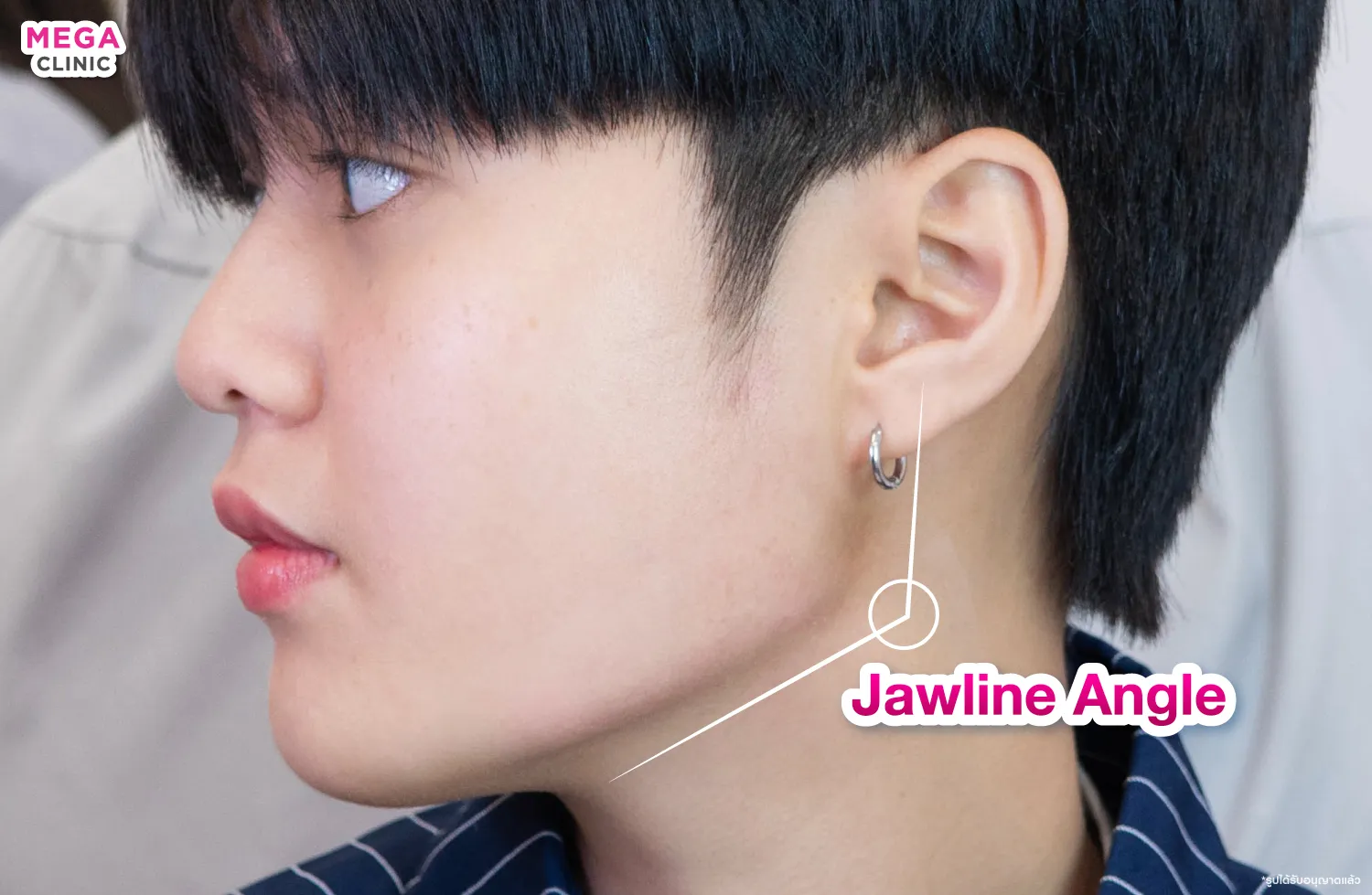 jawline กรอบหน้า คืออะไร
