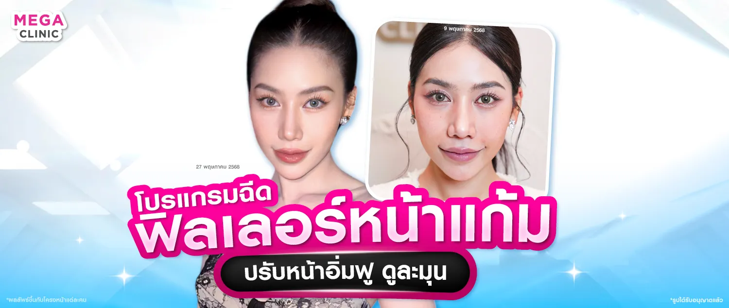 ฟิลเลอร์หน้าแก้ม แก้มส้ม