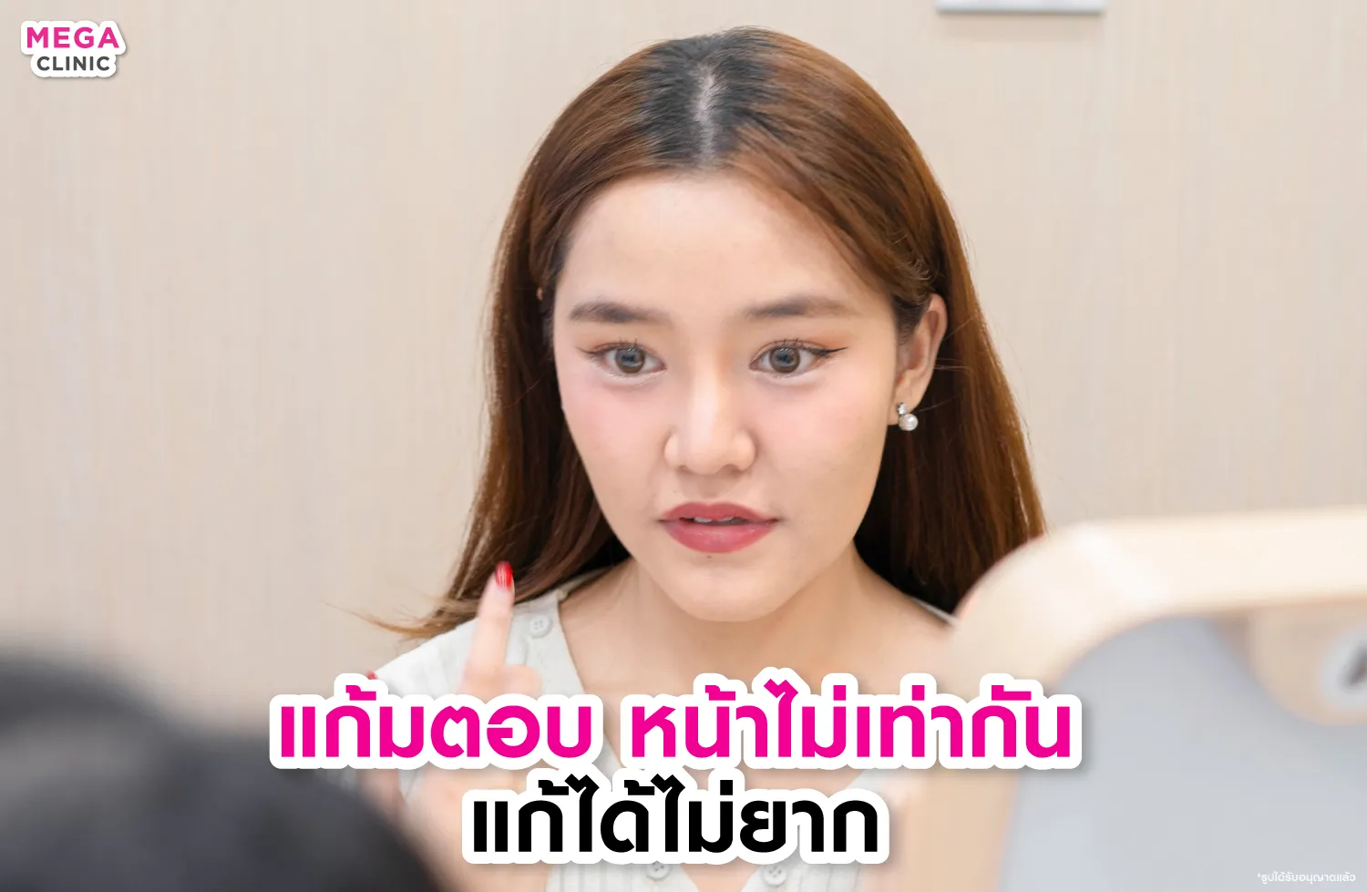 แก้มตอบ แก้ยังไง ฉีดฟิลเลอร์ที่ MEGA CLINIC