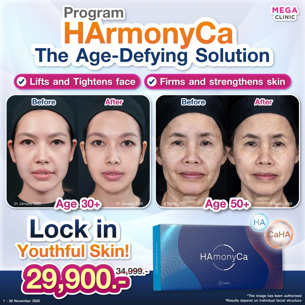 Web10_แปล_07112025_Mickey_1_result