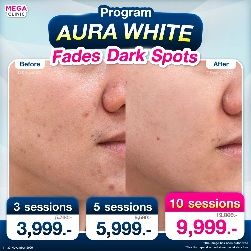 Web12_แปล_07112025_Mickey_result