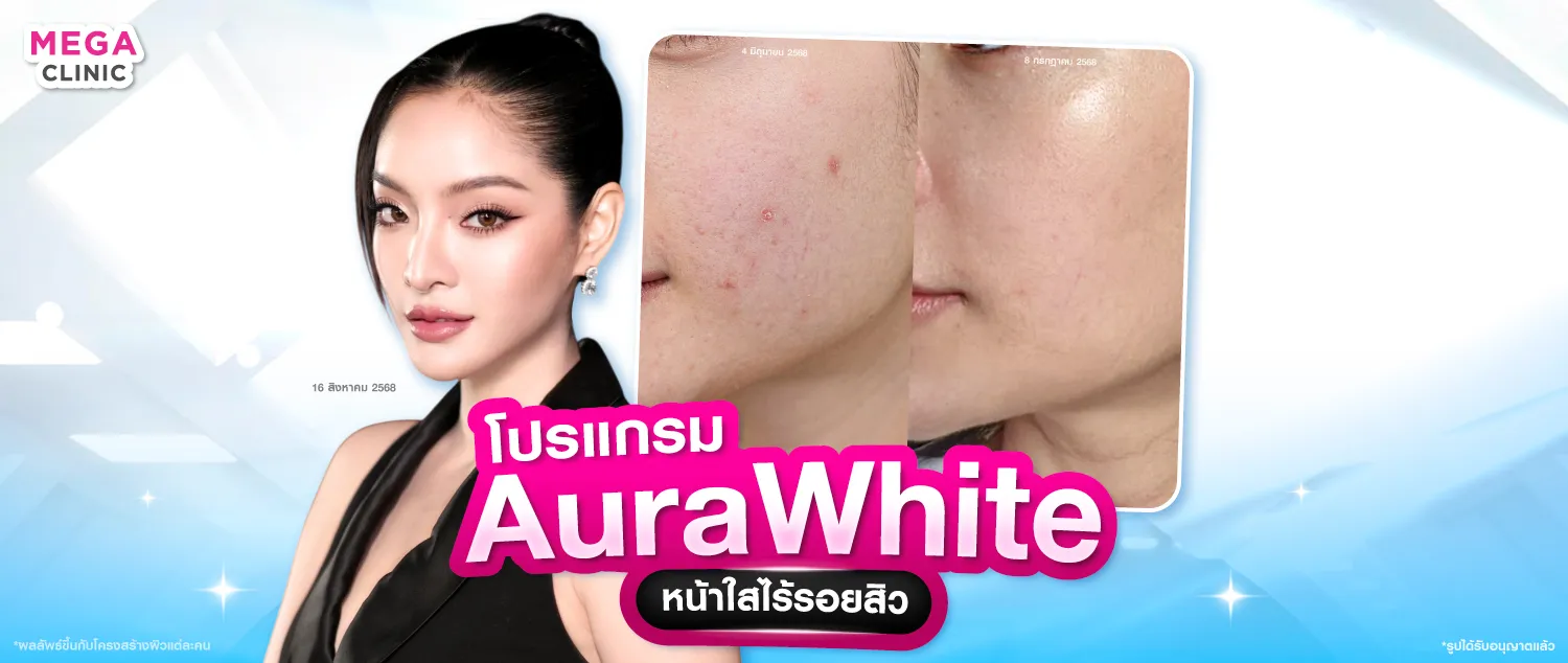 ออร่าไวท์ คืออะไร