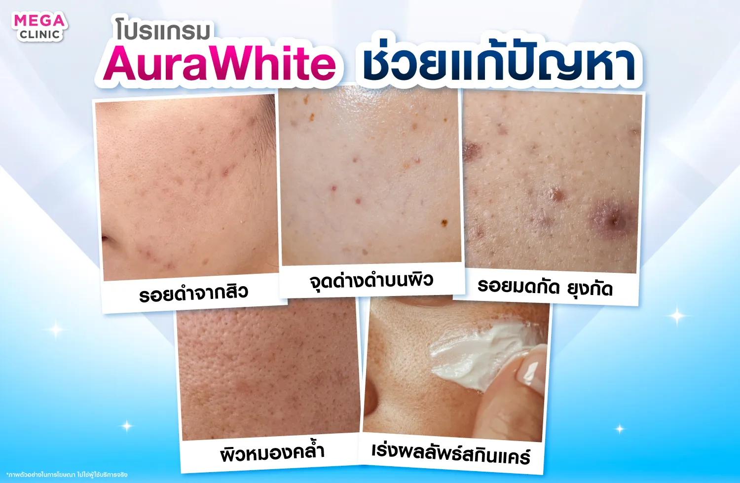 ออร่าไวท์ ช่วยอะไร