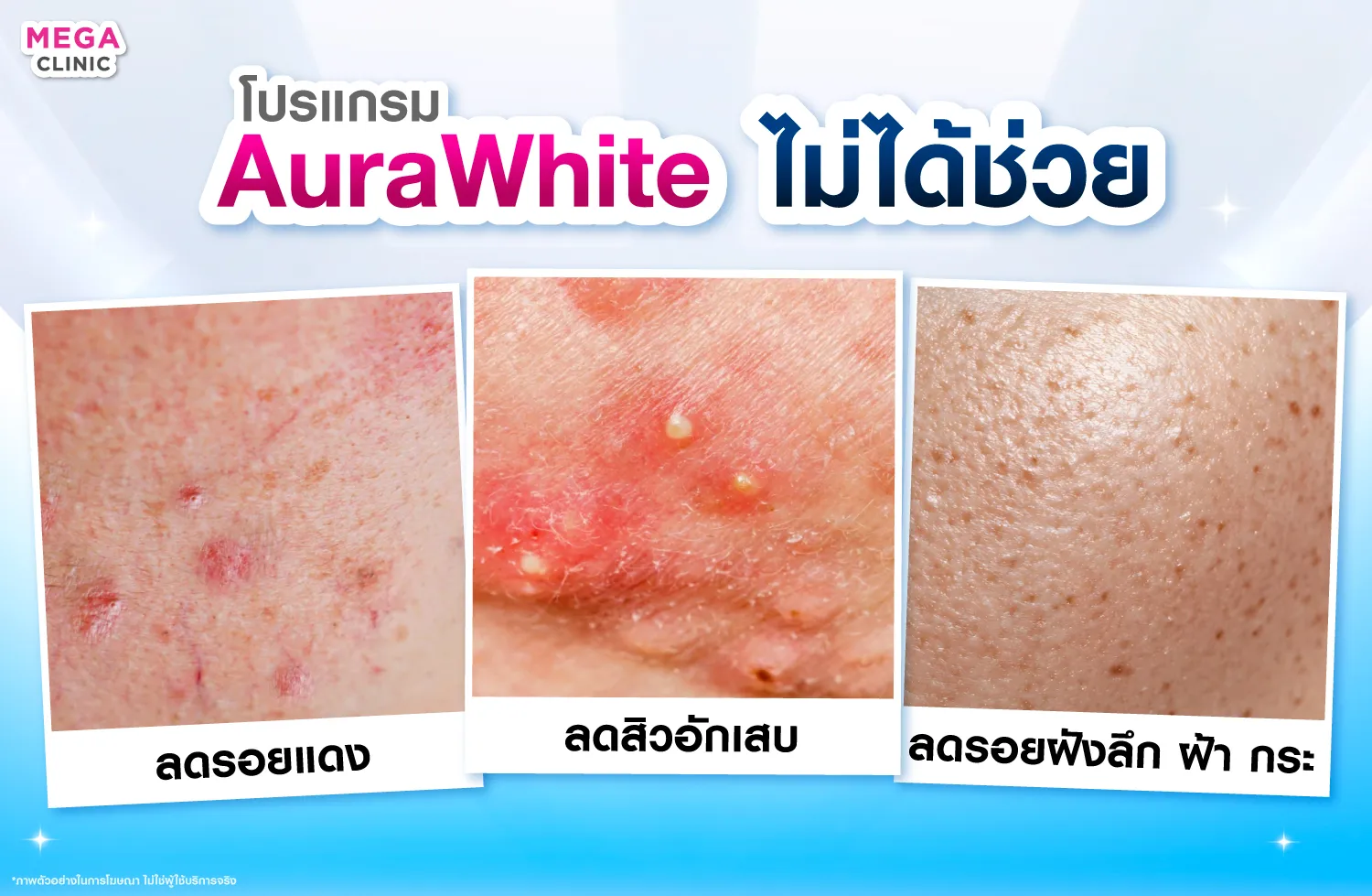 ออร่าไวท์ ไม่ได้ช่วยอะไรบ้าง