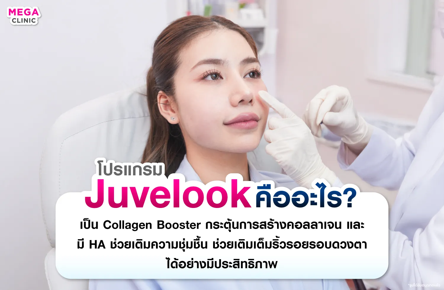 Juvelook คืออะไร