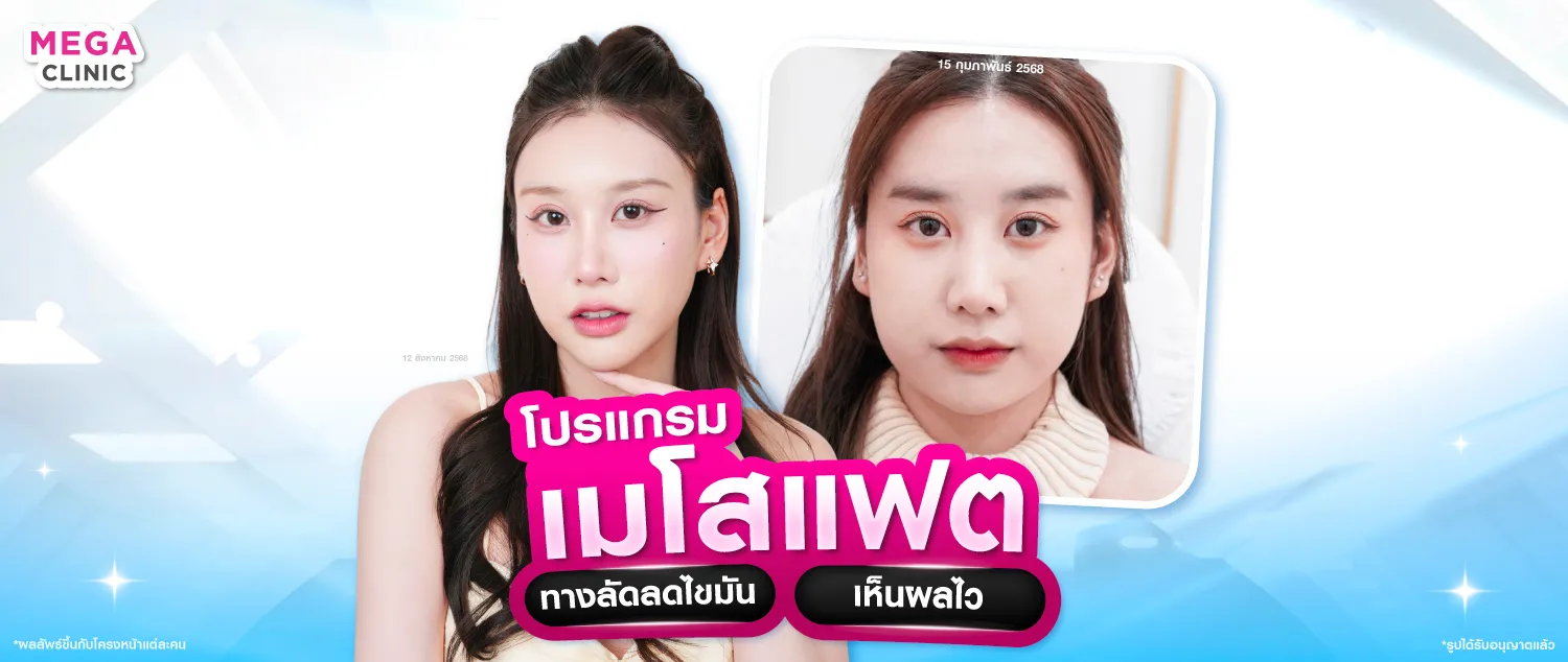 ฉีดแฟต เมโสแฟต ลดเหนียง ลดแก้ม ลดไขมัน เห็นผลไว