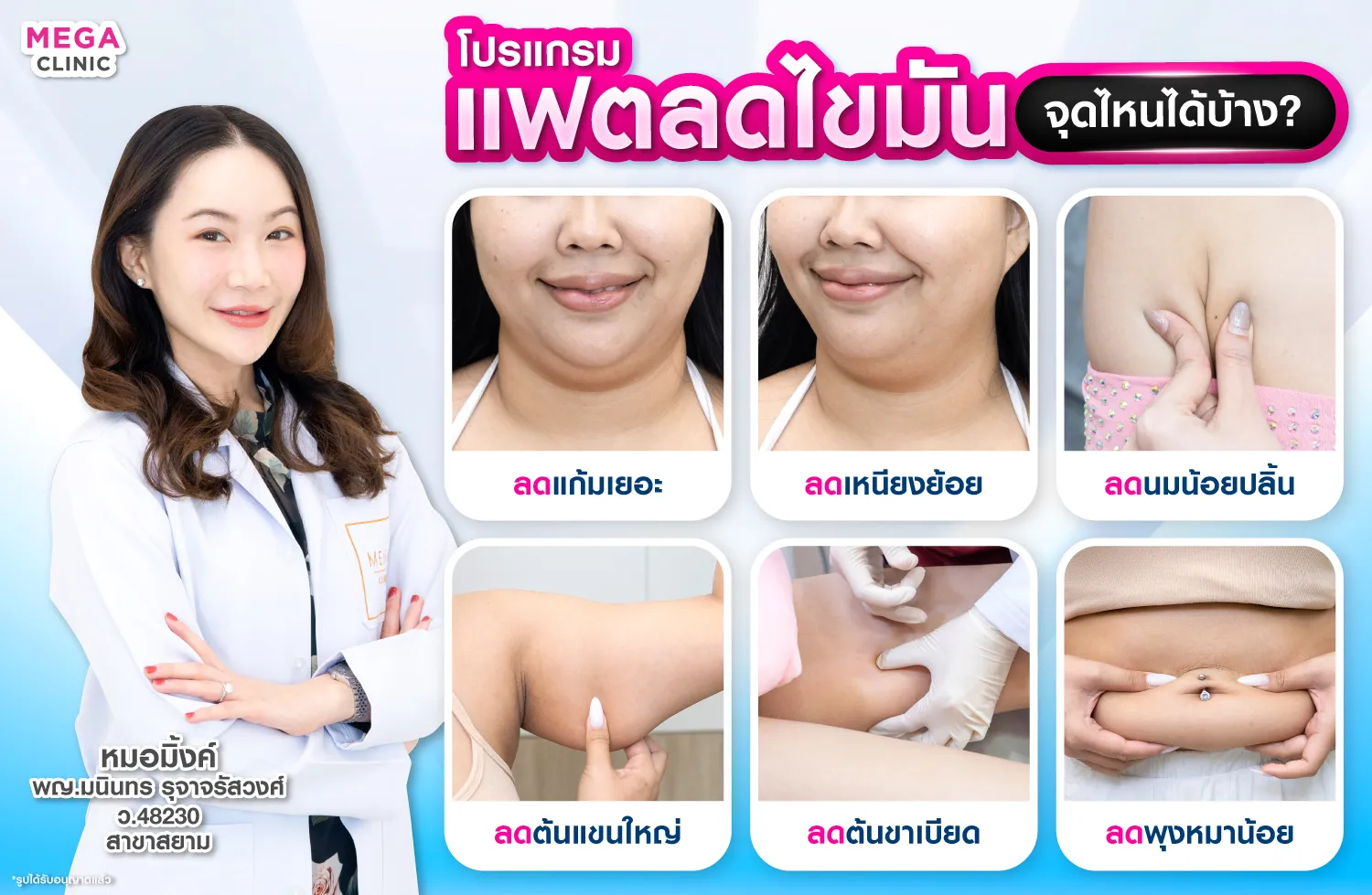 ฉีดแฟตลดไขมันตรงไหนได้บ้าง