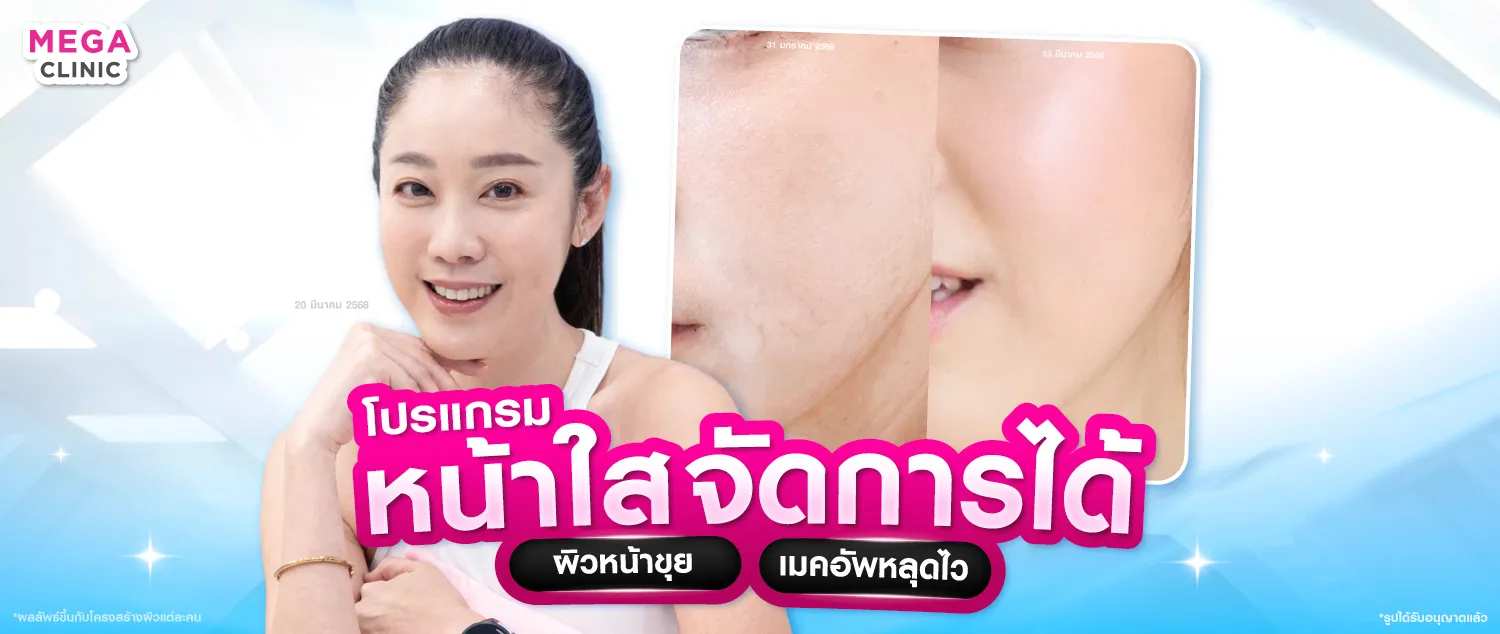 ฉีดหน้าใส ผิวชุ่มชื้น แก้ปัญหาผิวแห้ง ลดรอยสิว หน้าโทรม