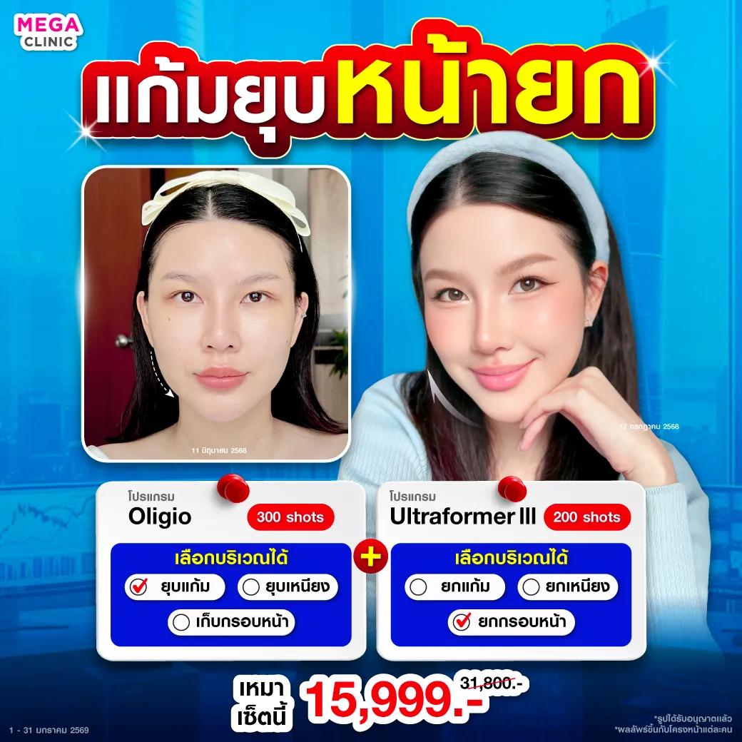 Web_แปล_30122025_Mickey_4_1_result