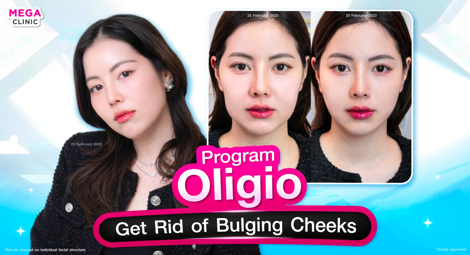 oligio คืออะไร