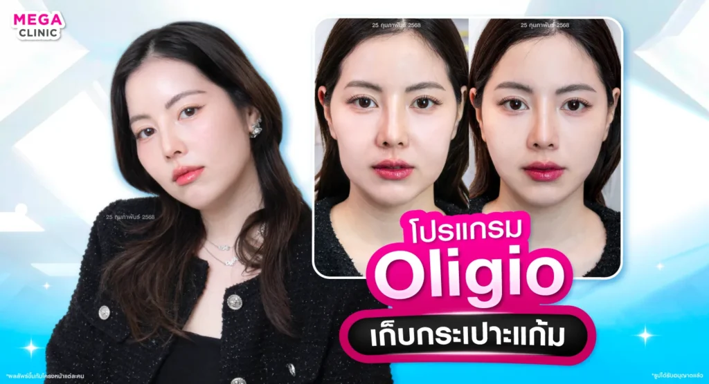oligio คืออะไร