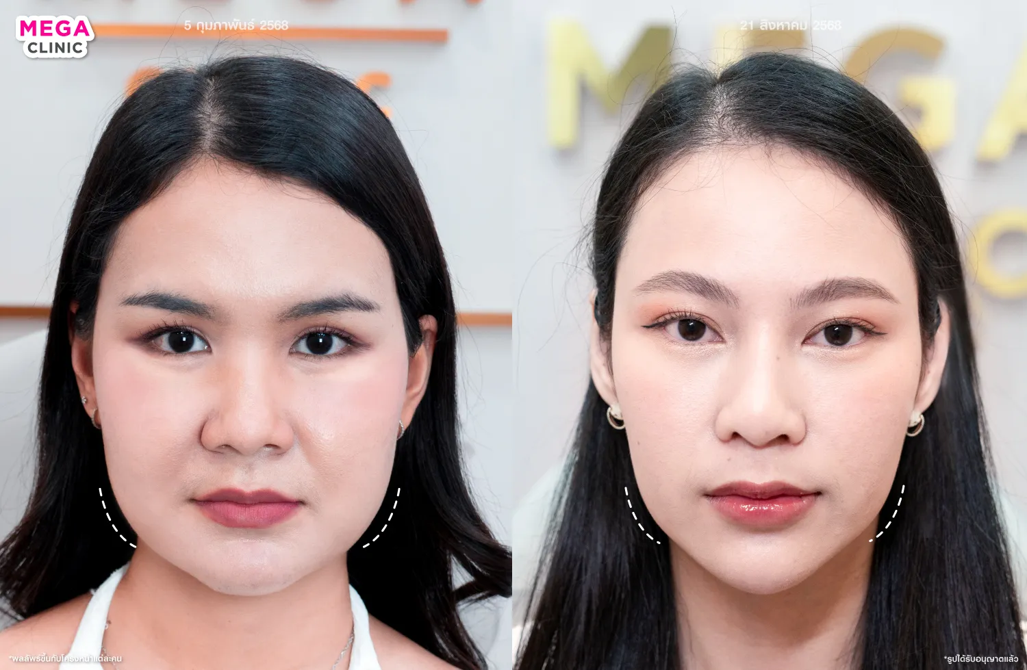 รีวิว oligio