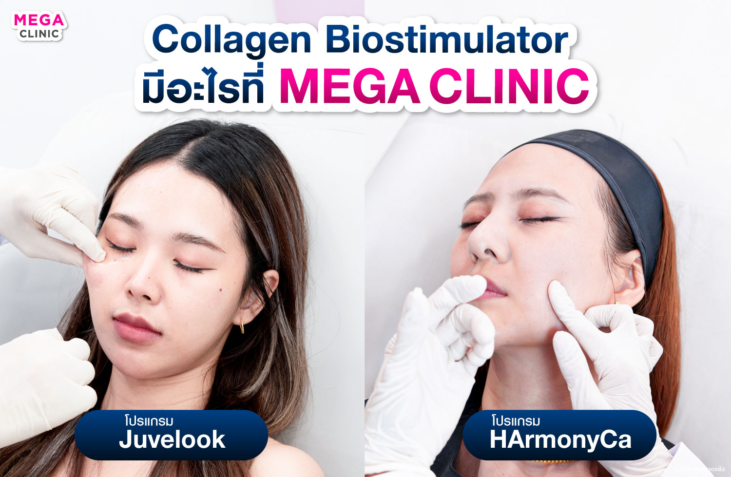 Collagen Biostimulator หัตถการช่วยกระตุ้นสร้างคอลลาเจนที่ MEGA CLINIC มี HarmonyCa และ Juvelook