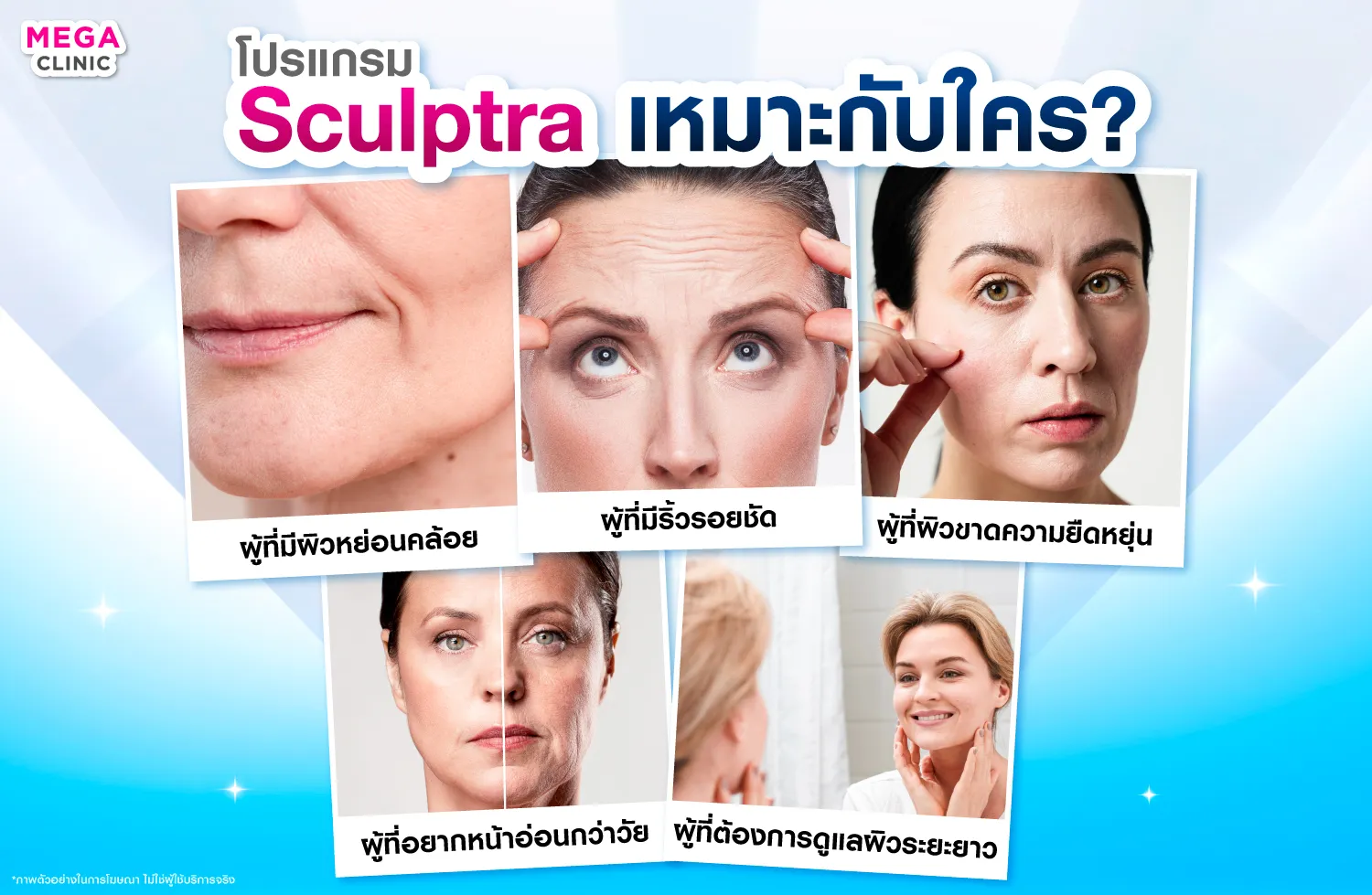 sculptra เหมาะกับใคร