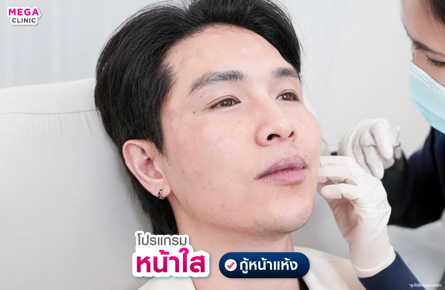 ฉีดหน้าใส แก้หน้าแห้ง