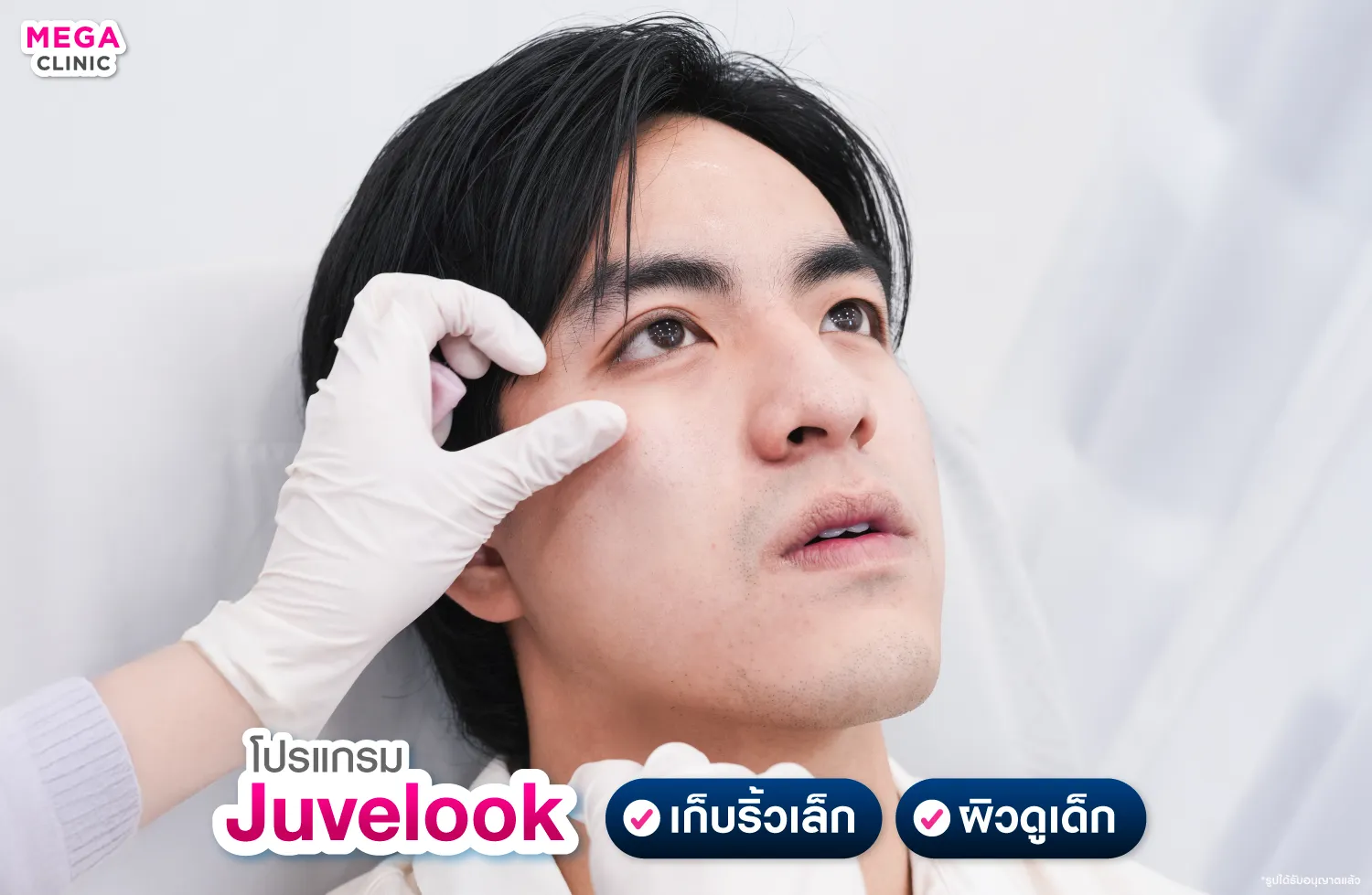 juvelook คืออะไร