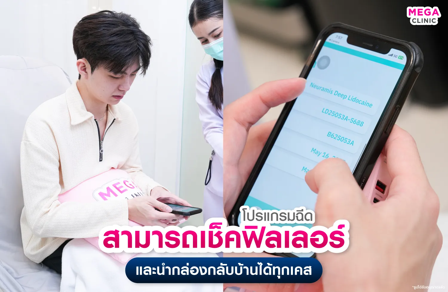 ที่ MEGA CLINIC สามารถตรวจสอบฟิลเลอร์ก่อนฉีดได้