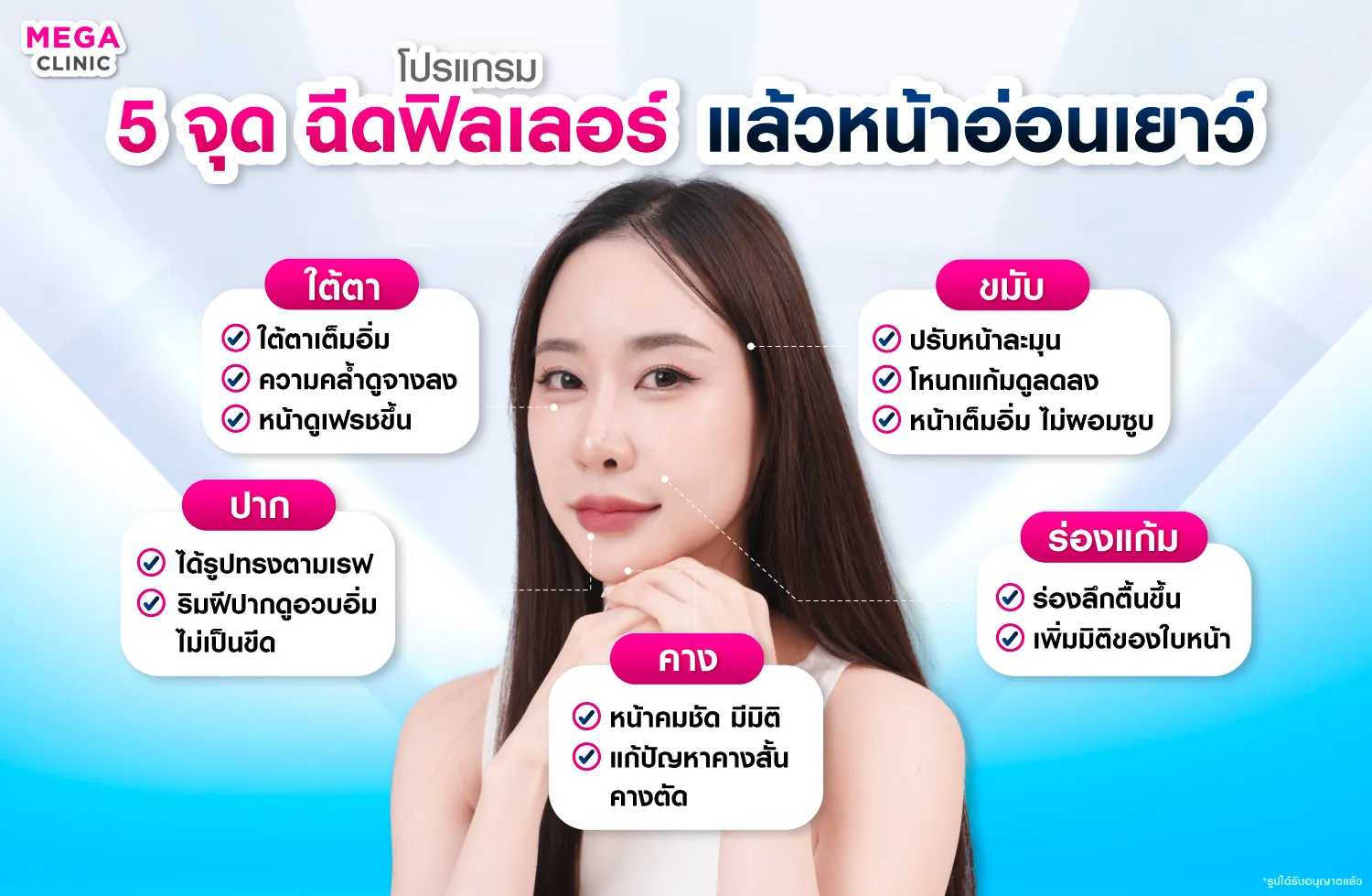 5 จุดฉีดฟิลเลอร์