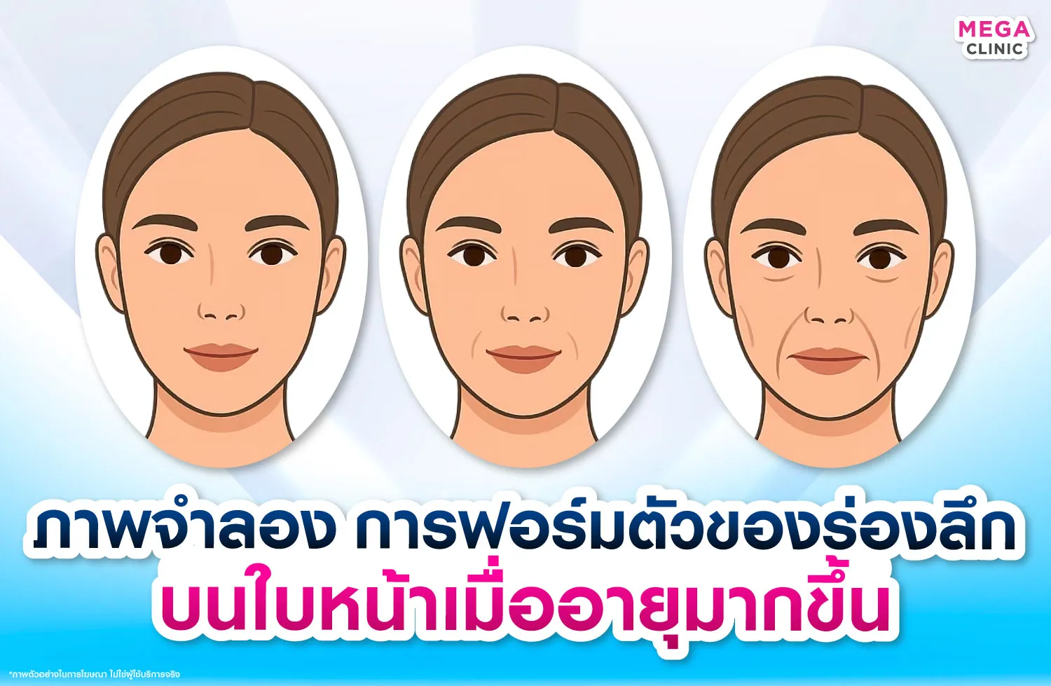 ร่องน้ำหมาก ทำให้หน้าแก่