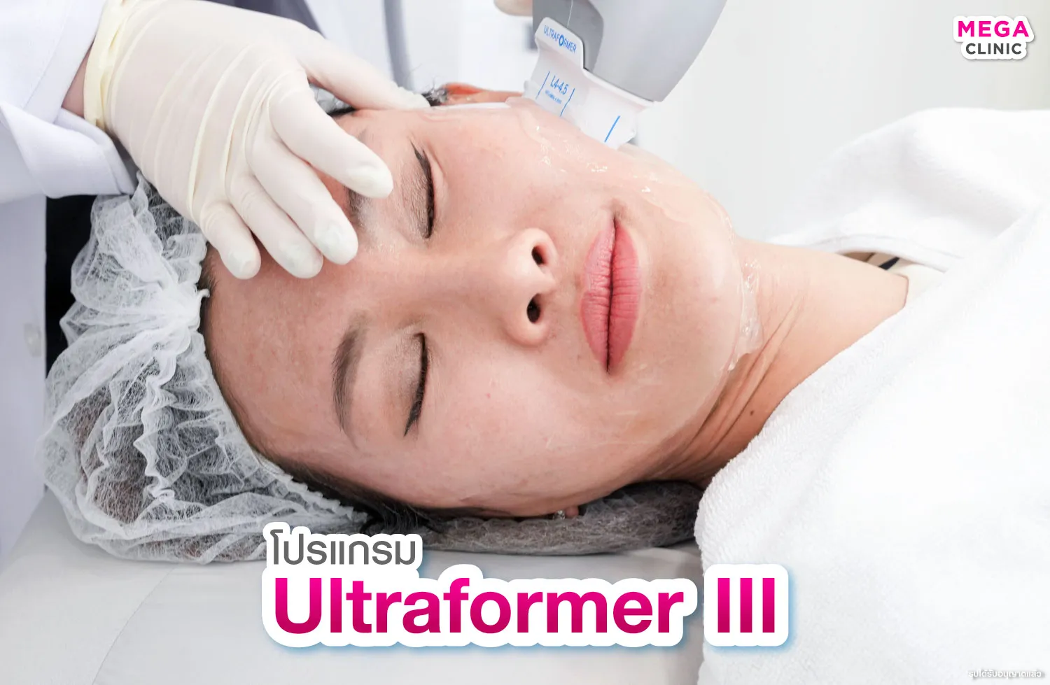 เครื่อง Ultraformer III ยกกระชับผิว