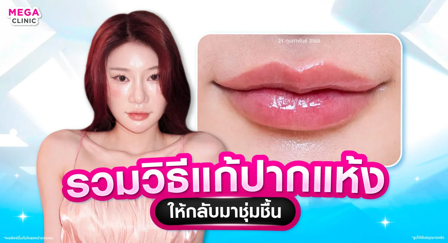 วิธีแก้ปากแห้ง