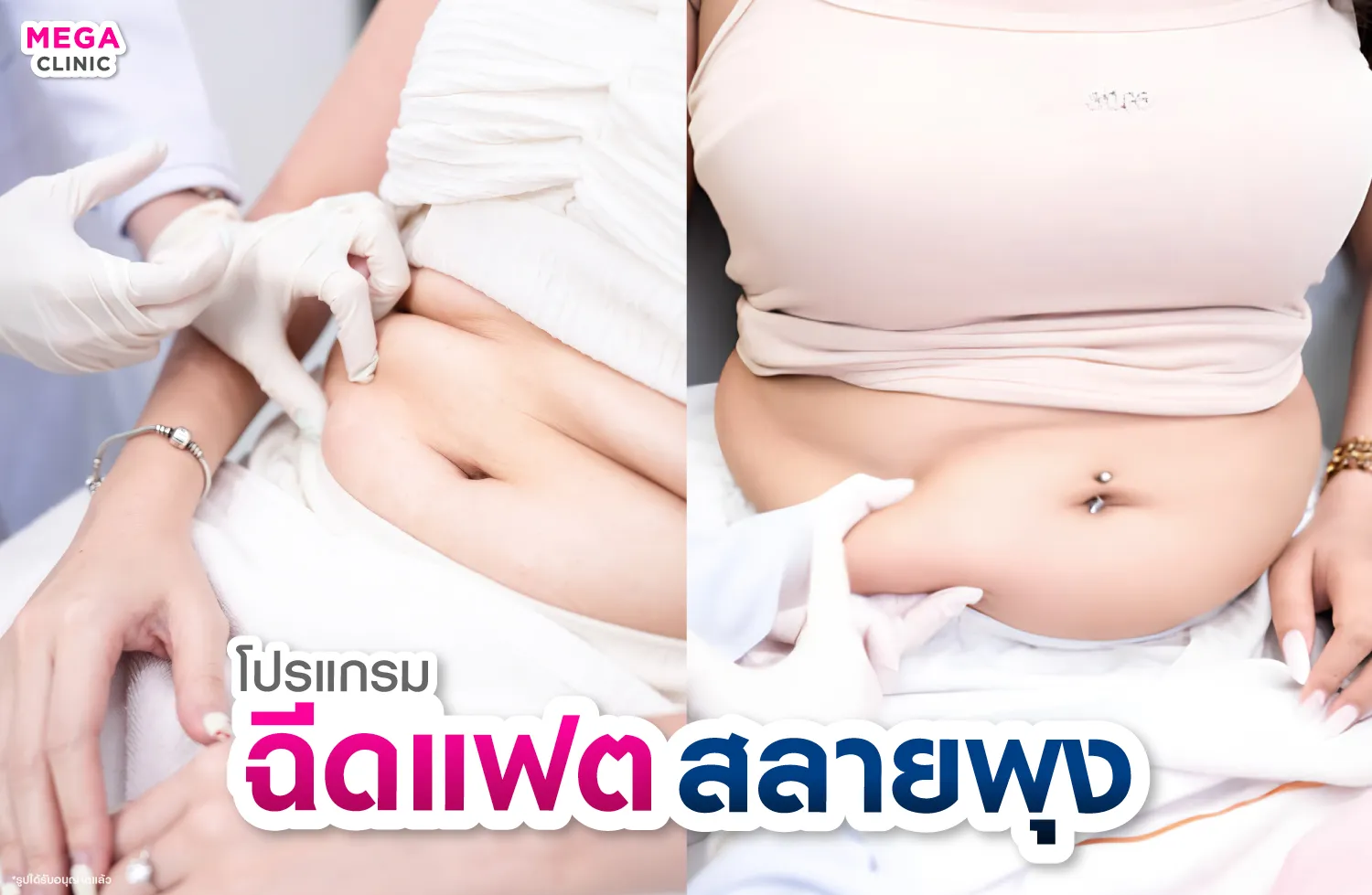 ฉีดแฟตสลายพุงหมาน้อย