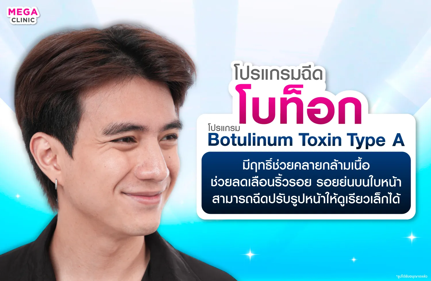 ฉีดโบท็อกลดรอยตีนกา