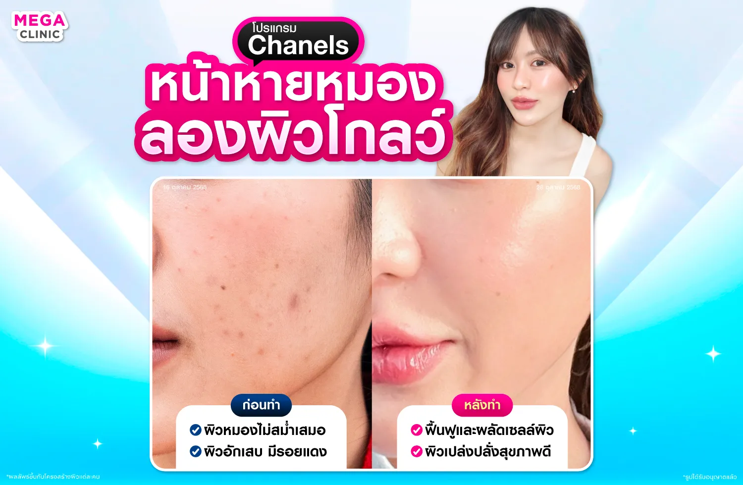 ฉีดชาแนล ฟื้นฟูและปรับสภาพผิว ลดจุดด่างดำและรอยแดงจากสิว