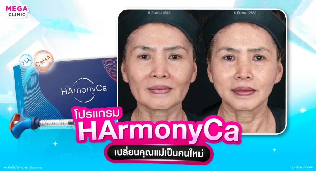 HArmonyCa คืออะไร