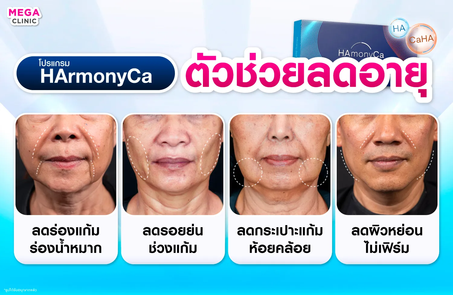 HArmonyCa ช่วยเรื่องอะไร
