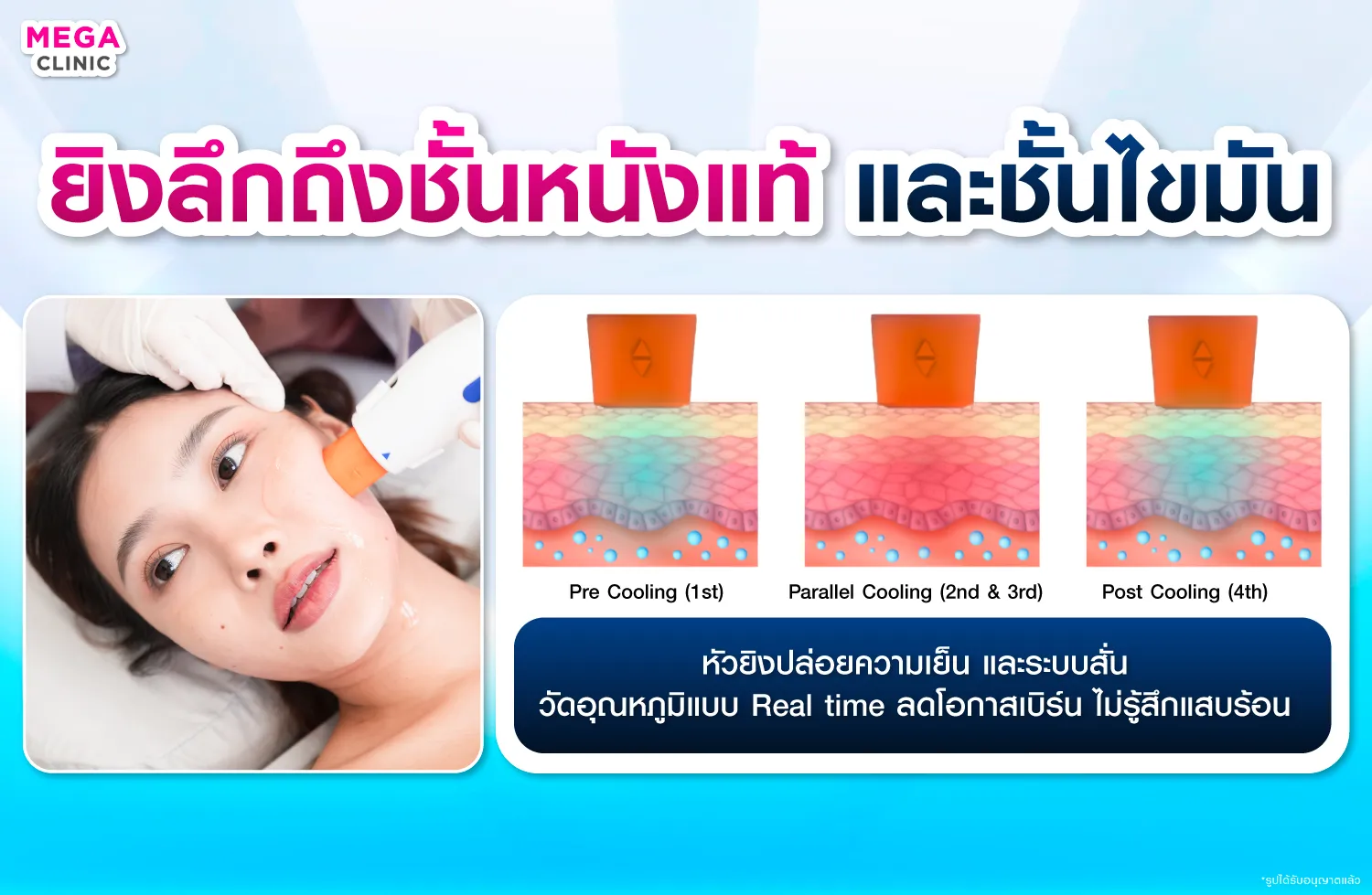 oligio ทำงานอย่างไร