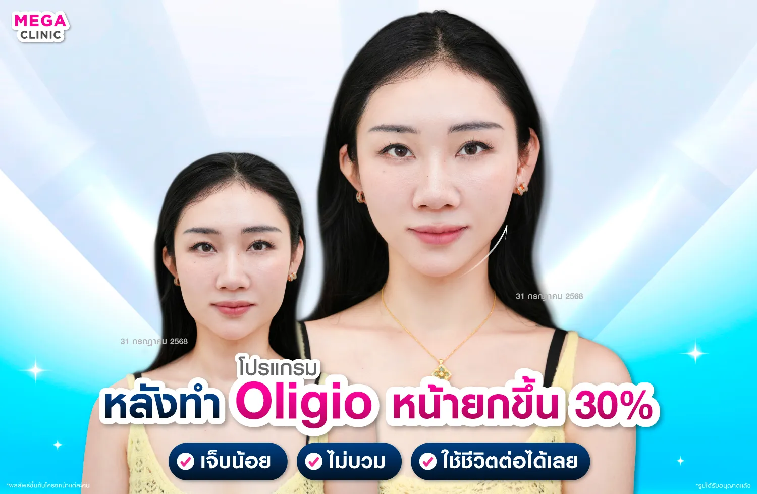 oligio ยกกระชับผิวหย่อนคล้อย