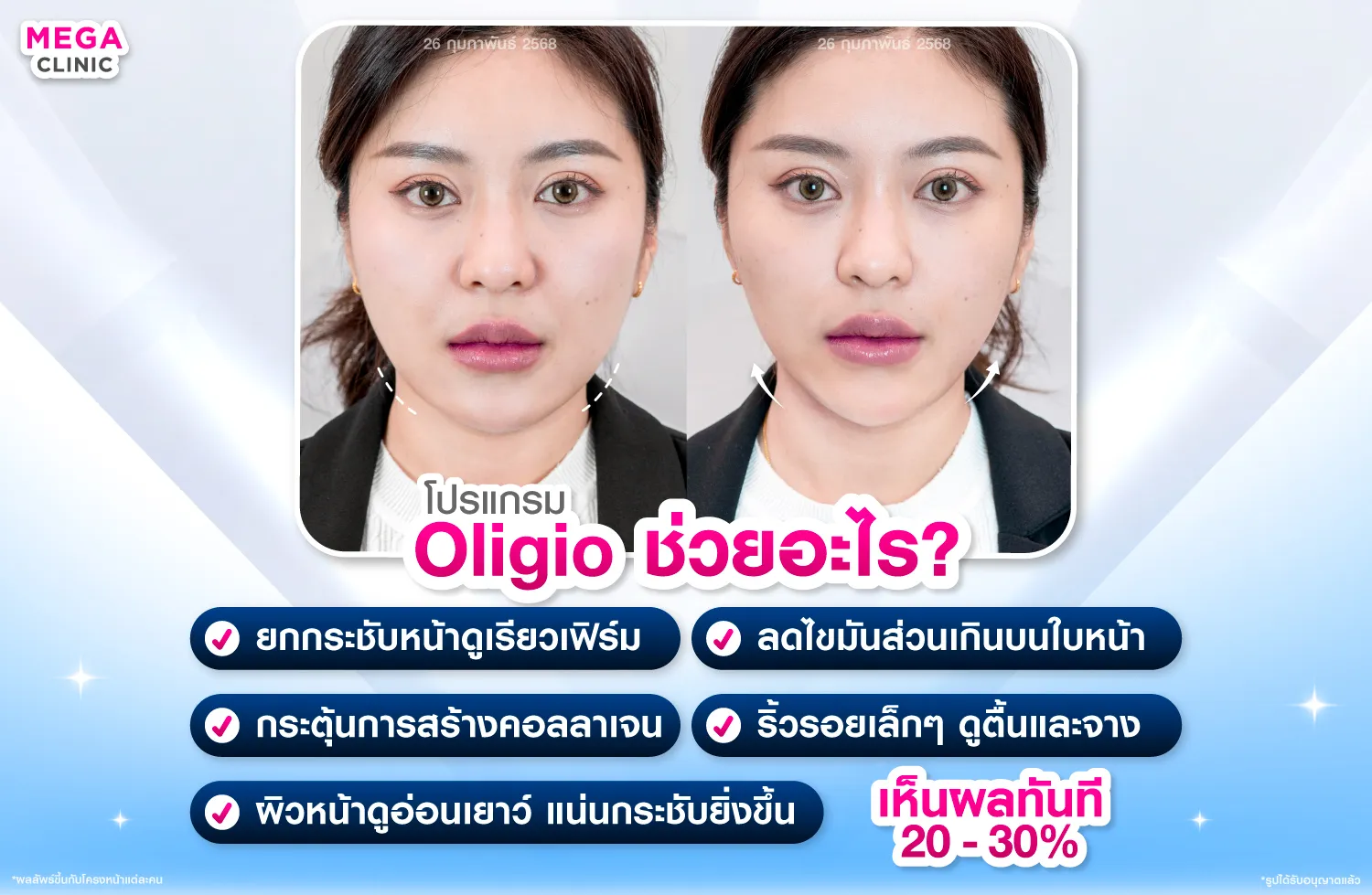 oligio ช่วยอะไร