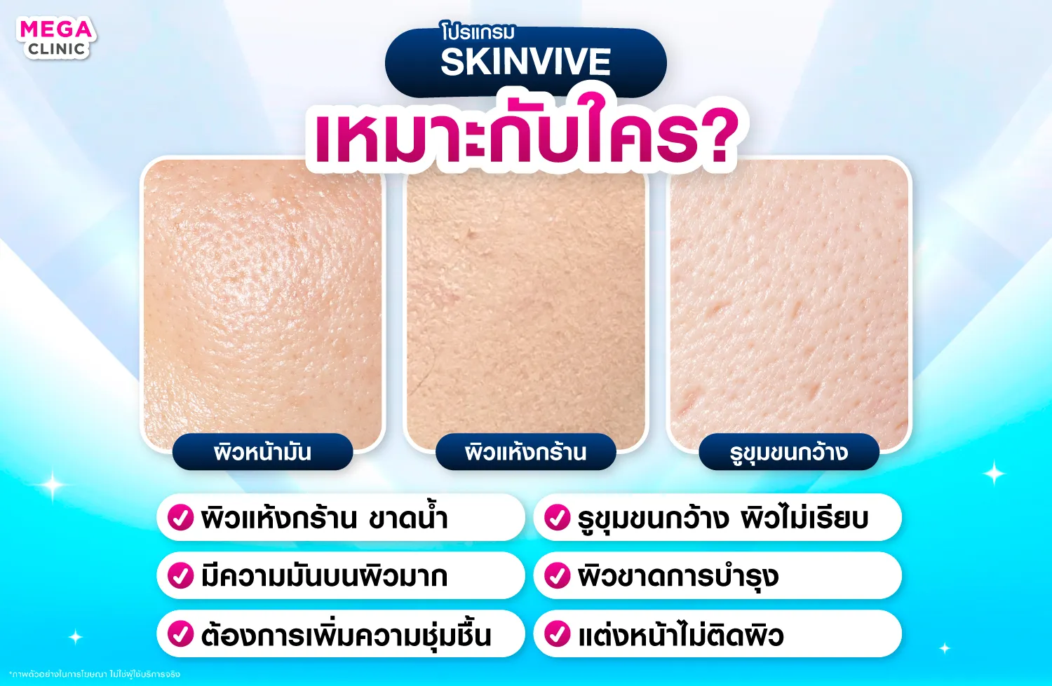 Skinvive เหมาะกับใคร