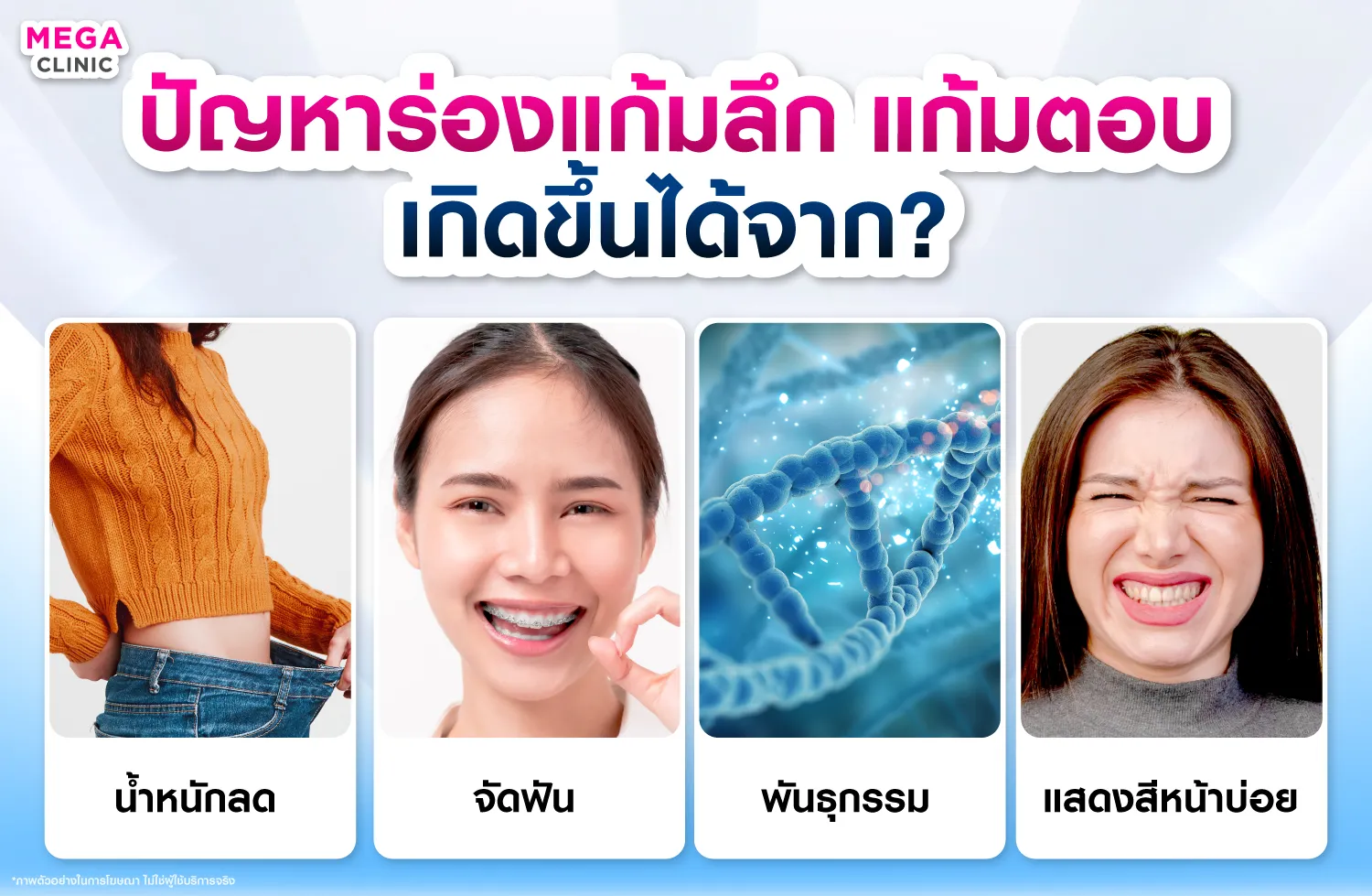 สาเหตุของแก้มลึก แก้มตอบ