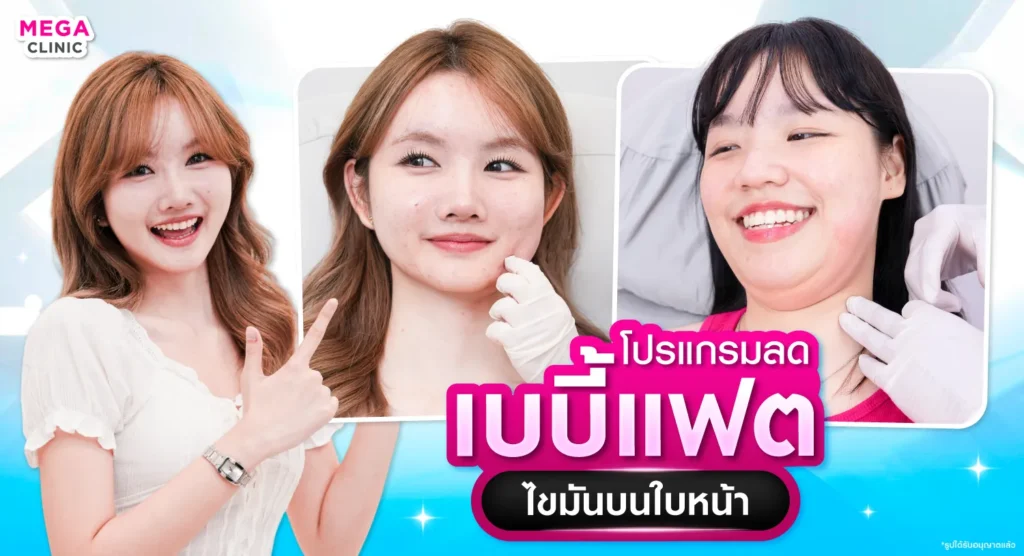 baby fat คืออะไร