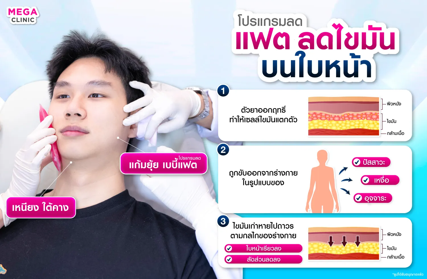 การออกฤทธิ์ของตัวยา Lipo-S ในการฉีดแฟตสลายไขมัน