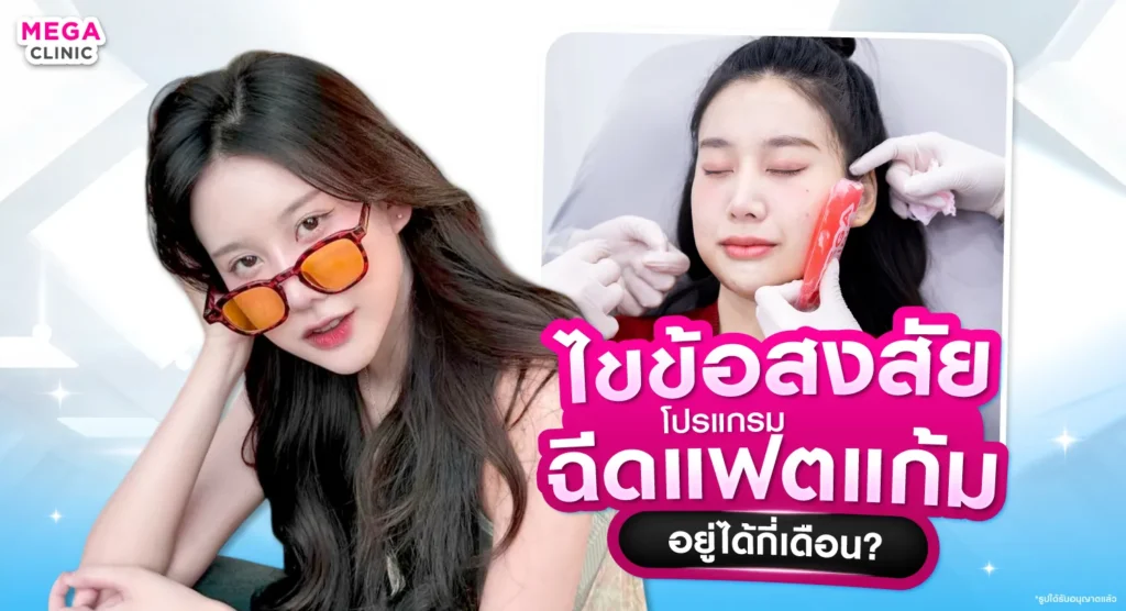 ฉีดแฟตแก้ม อยู่ได้กี่เดือน?