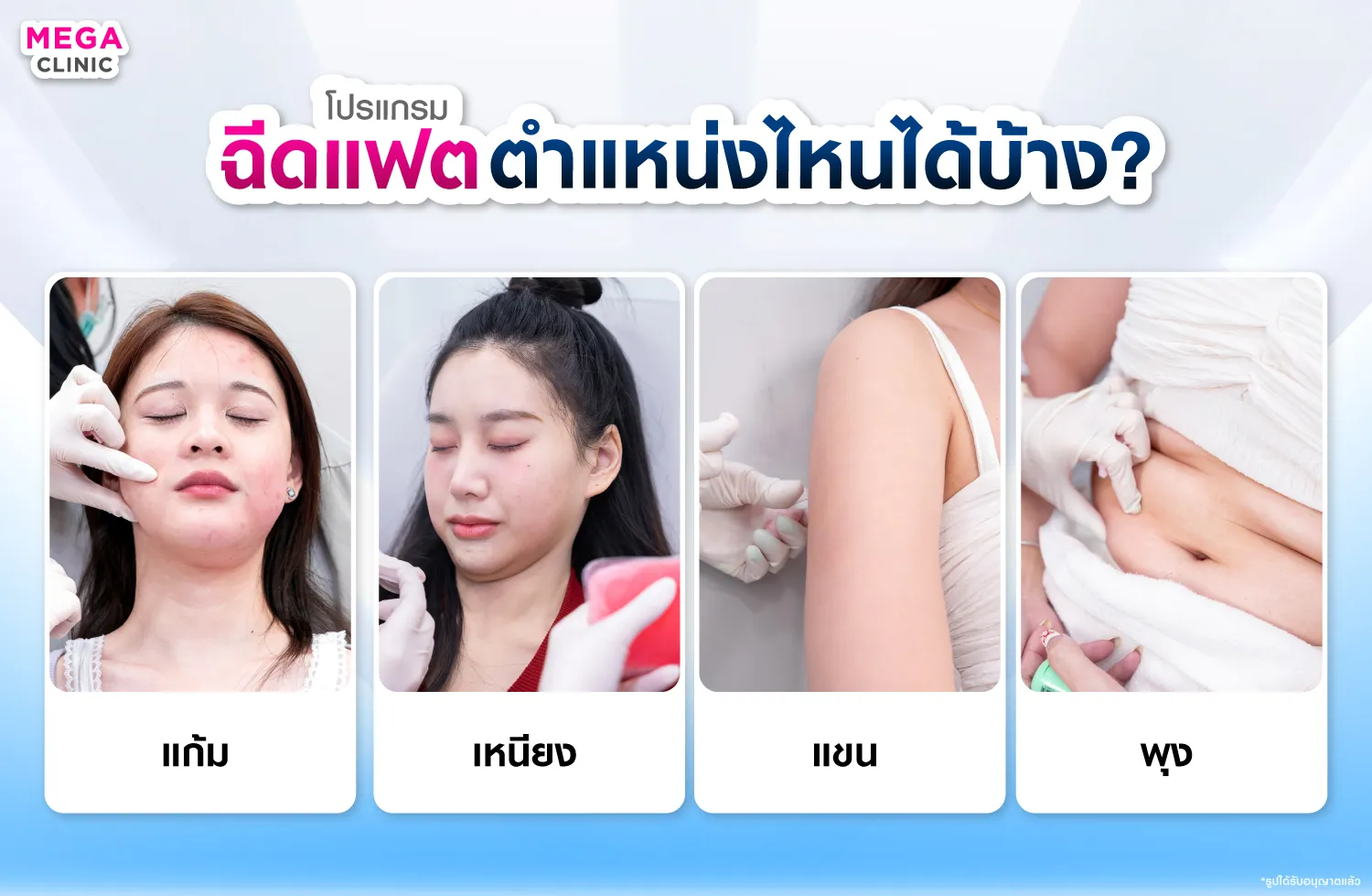 ฉีดแฟตตำแหน่งต่างๆ
