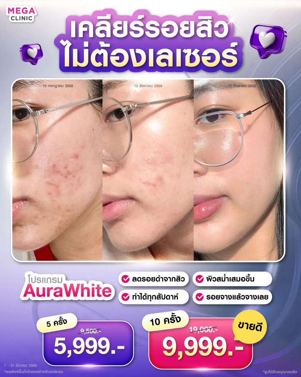 FB_Resize_04022026_Mickey_result