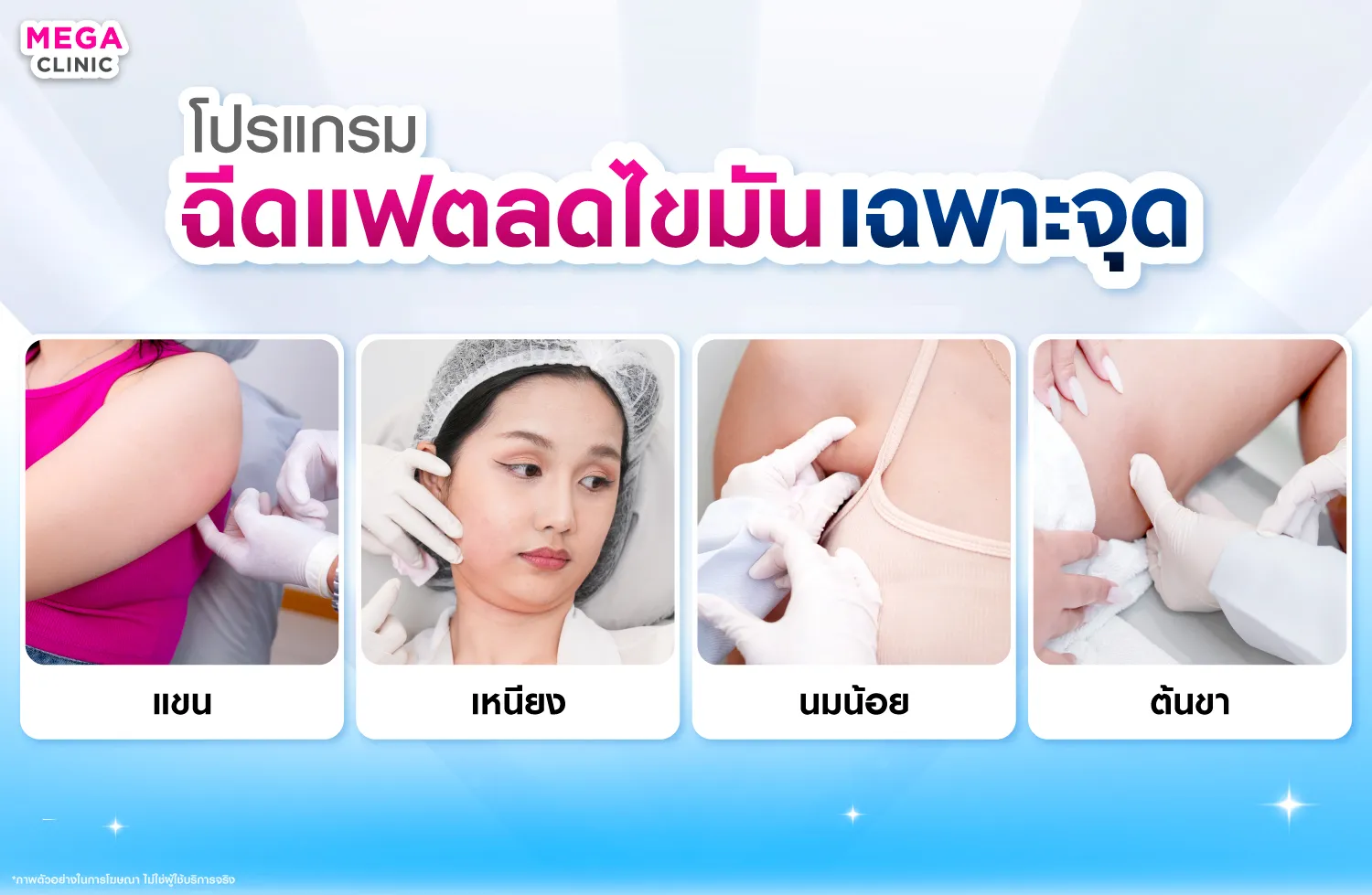 ฉีดแฟตลดไขมันเฉพาะจุด