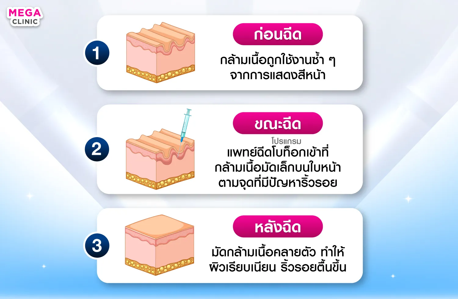 โบท็อกหน้าผากทำงานยังไง
