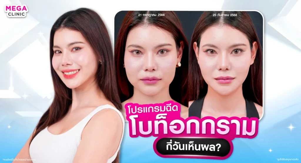 ฉีดโบลดกราม กี่วันเห็นผล