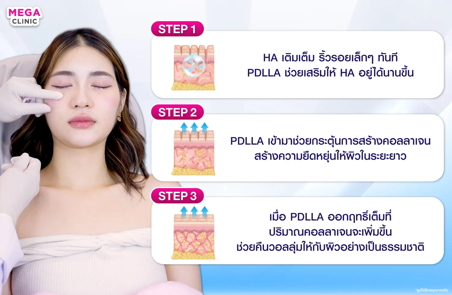 Juvelook ทำงานอย่างไร